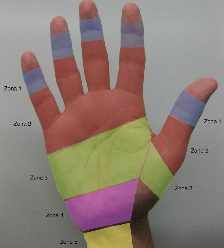 esquema de los musculos de la mano
