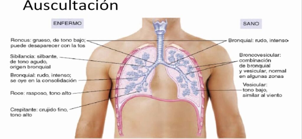 esquema de maduracion pulmonar acog